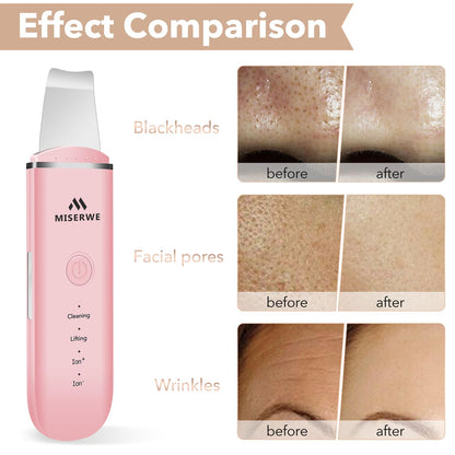 Skin Scrubber Face Skin Spatula Facial Scrubber Spatula Pore Cleaner with 4 Modes (Pink)