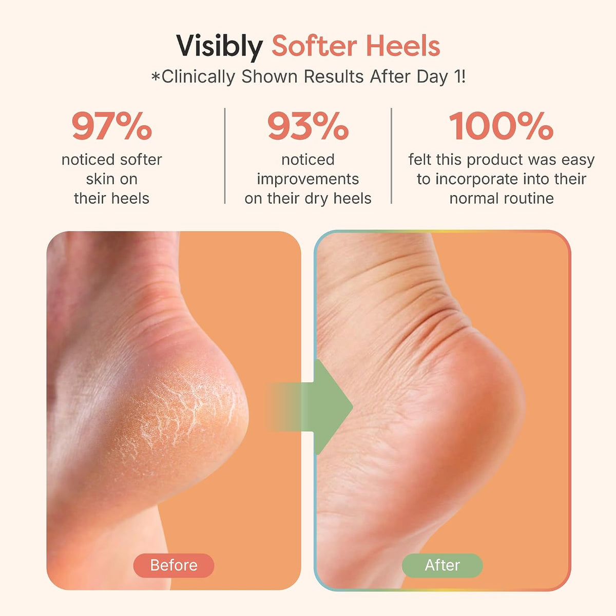 Moisturizing Heel Socks for Dry Cracked Heels, 2 Pairs