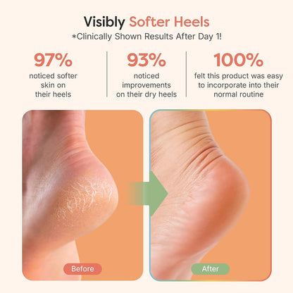 Moisturizing Heel Socks for Dry Cracked Heels, 2 Pairs